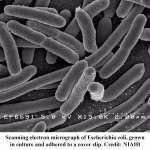 Semen Microbiome Influence on the Mare Uterine Microbiome - e-coli bacteria, a common equine uterine bacteria