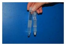 Colloid Centrifugation for Semen - On left prior to centrifugation, on the right after centrifugation. Photo: Morrell et al.