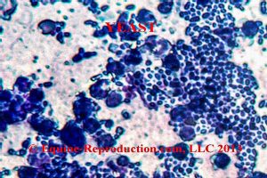 The importance of uterine cytology - yeast cells