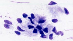 Breeding a mare with shipped semen - Normal epithelial cells in cytology