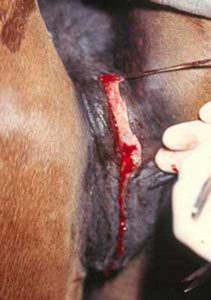 Removal of a very narrow strip of mucosa.