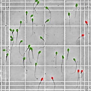 Counting Sperm With a Hemocytometer
