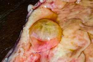 Close up of a large uterine cyst in a mare