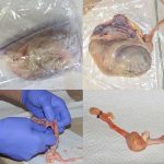 Epididymal Sperm Collection and Processing