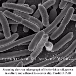 Semen Microbiome Influence on the Mare Uterine Microbiome
