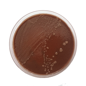 CEM Outbreak - Chocolate Eugon - Prepared Culture Media For Taylorella Equigenitalis showing growth