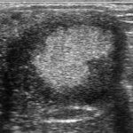 Seasonal absence of accessory ovulations