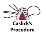 Vulval Conformation and Caslick's Procedure