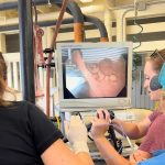 Endometrial Cup Regression