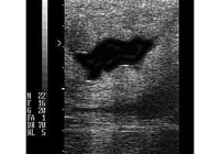 Uterine fluid in the mare visible on ultrasound