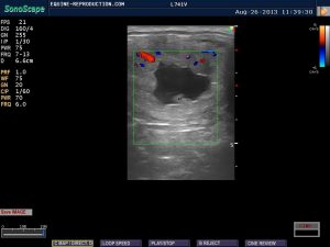 mare ultrasound pregnancy images 21 day CD image