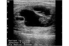 Day 45 pregnancy per ultrasound