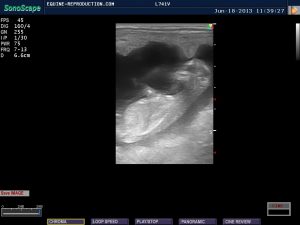 53 day fetal side view