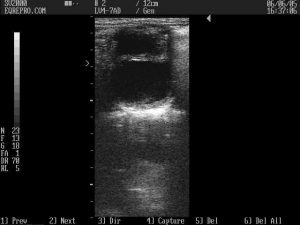 Predicting Ovulation in the Mare - double follicles