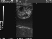 Steroidal Secretion Effects on Uterine Ultrasound Characteristics