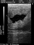 Oxytocin use when breeding a mare - free fluid visible on ultrasound