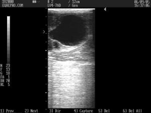 Predicting Ovulation in the Mare - teardrop shaped follicle