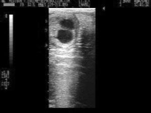 Managing Twinning in the Mare - twins ultrasound at 14 days