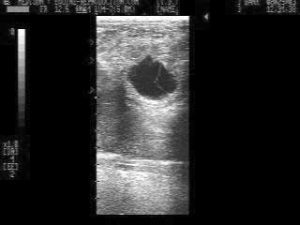 Managing Twinning in the Mare - twins ultrasound at 18 days