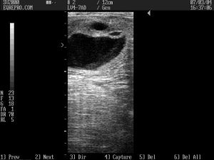 Predicting Ovulation in the Mare - leaking follicular fluid